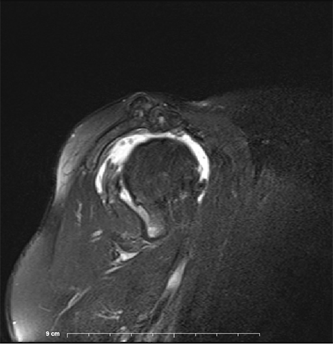 Image MRI
